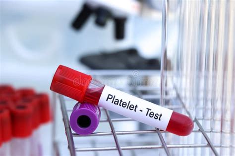 Platelet Test To Look For Abnormalities From Blood Stock Photo Image