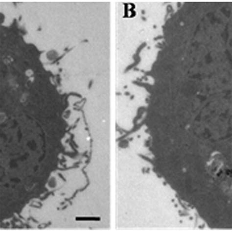 Cytotoxicity Of Dox Loaded Magnetic Nanocarriers And Free Dox In Hela