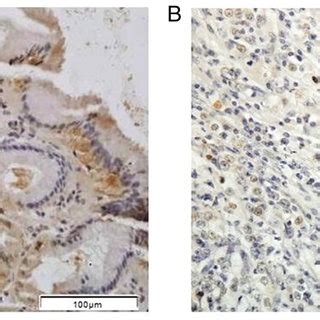 Immunohistochemical Pattern Of Dishevelled Segment Polarity Protein