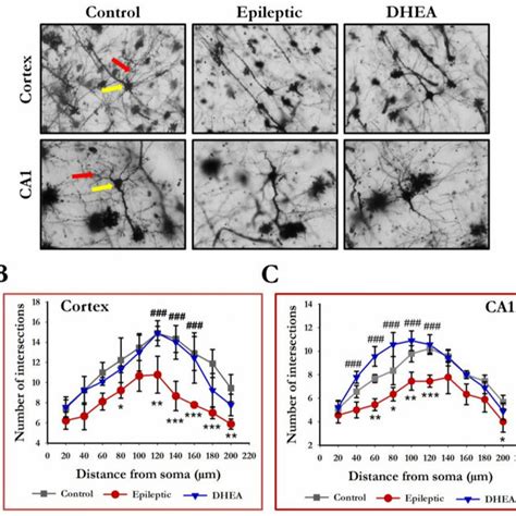 Dendritic Arborization In The Cortex And Hippocampus Of Control