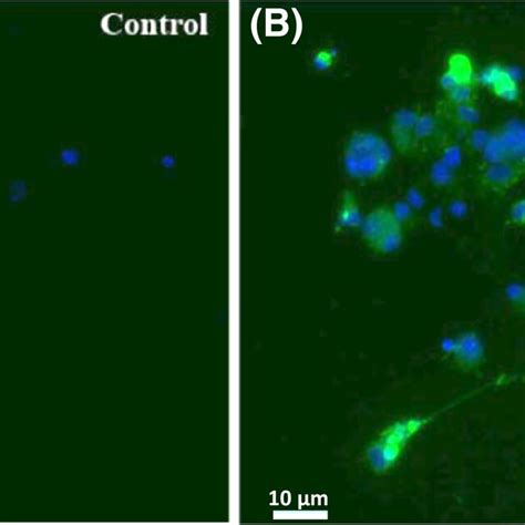 Uptake Of Labeled Ltc By Macrophages Macrophages From Pbmc Incubated