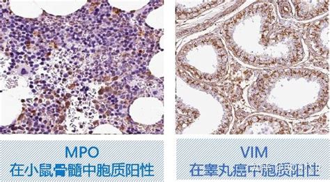 免疫组化IHC实验从入门要高阶一篇搞定 知乎