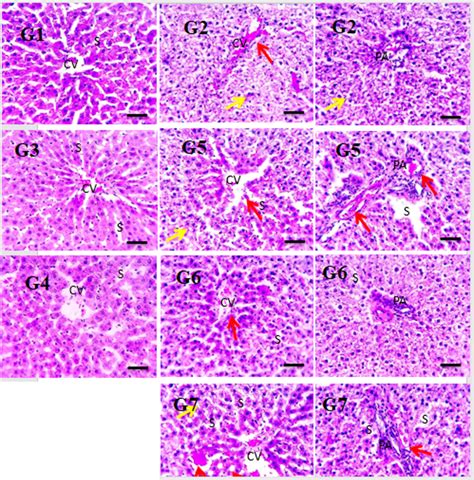 Microscopic Pictures Of H E Stained Liver Sections Showed The Normal