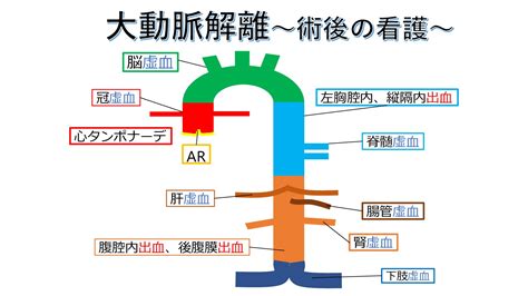 「大動脈解離の前兆を解説！吐き気や胸・背中の痛みに注意」 オルタナティブ アトム