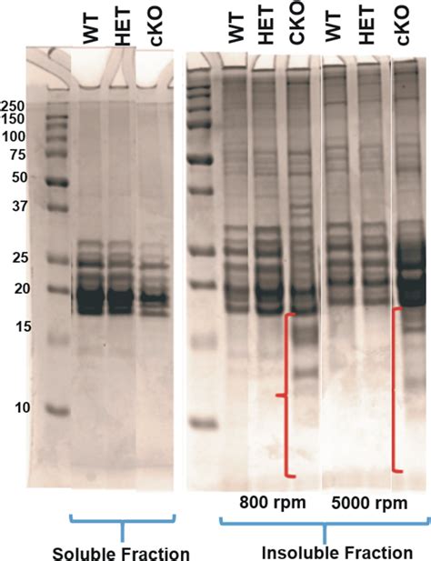 SDS PAGE Analysis Of Insoluble And Soluble Protein Fractions From