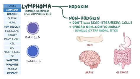 Lymphomas Pathology Review Video And Anatomy Osmosis