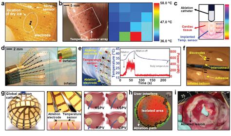 PDF Wearable And Implantable Devices For Cardiovascular Healthcare