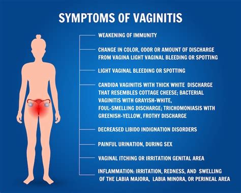 Infográfico De Sintomas De Vaginite Em Ilustração Vetorial Vetor Premium