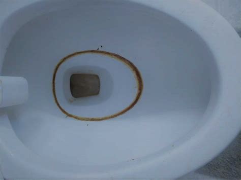 What Causes Black Ring In Toilet Bowl | Storables