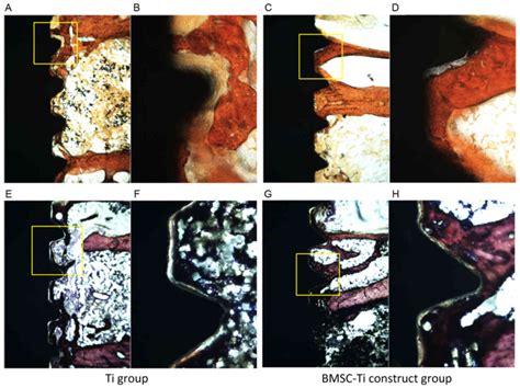 Enhanced Osseointegration Of Titanium Implants In A Rat Model Of Osteoporosis Using Multilayer