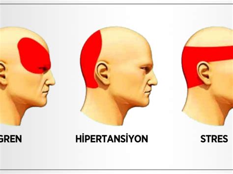 Baş neden ağrır? - Mediden Sağlıklı Yaşam Merkezi | Denizli