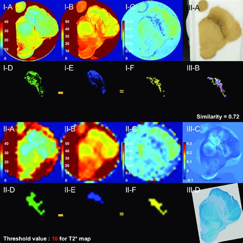 Neuromelanin Segmentation By T 2 And T 2 Thresholding From The Tissue Download Scientific