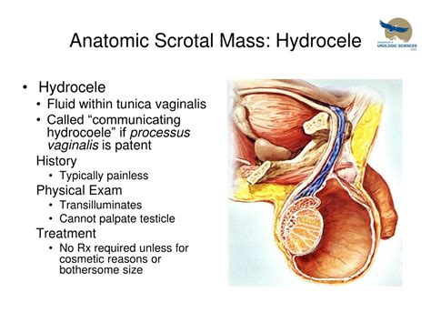 Ppt Scrotal Masses Powerpoint Presentation Free Download Id 9140050