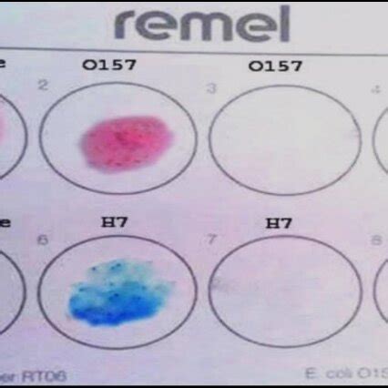 Positive Results Of O And H Antigens With Latex Agglutination Test