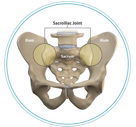 Sacroiliac Joint Alevio Spine