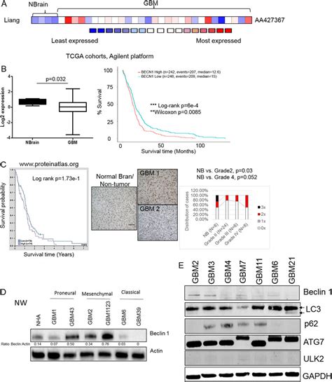 Expression Analysis Of Beclin 1 And Autophagy Related Proteins In The