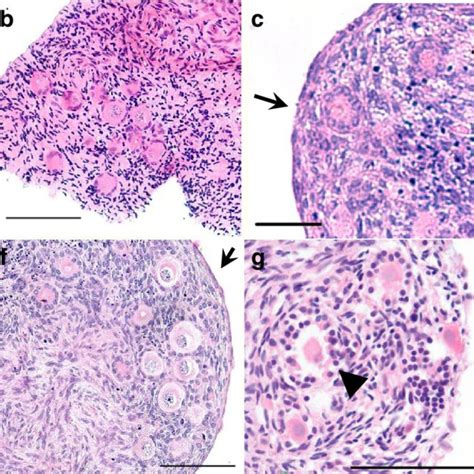 Pdf Alginate Encapsulation Supports The Growth And Differentiation Of