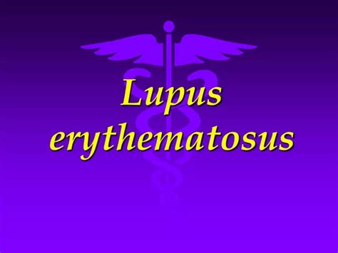 Ppt Lupus Erythematosus Powerpoint Presentation Free Download Id 9738030