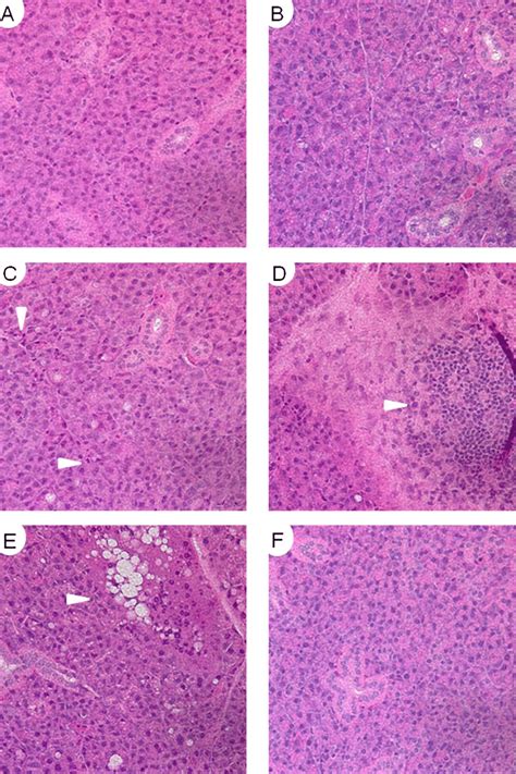 Histological Analysis Of Parotid Salivary Gland Structure 90 Days After