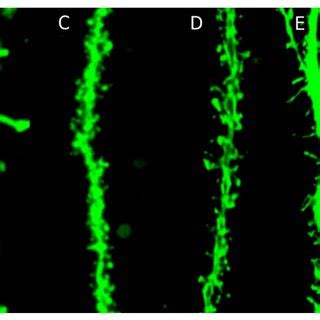 Morphological diversity of dendritic spines. (A) Spine shape ... 