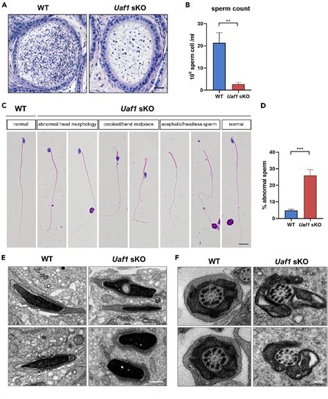 Figure 5 From The Deubiquitinase Cofactor Uaf1 Interacts With Usp1 And