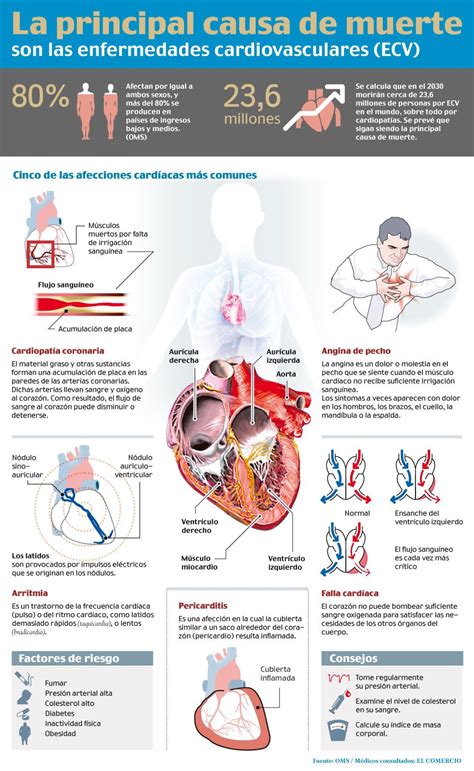 Las enfermedades que afectan al corazón EL COMERCIO Patologias