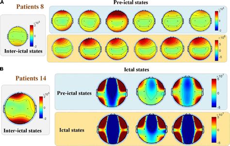 Comparisons Among The Three Groups In The Spatial Distribution Of Eeg