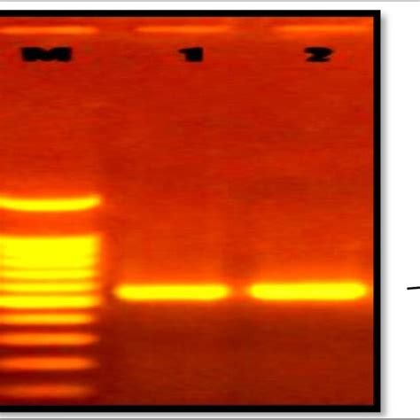 Illustrates The Results Of Agarose Gel Electrophoresis For The