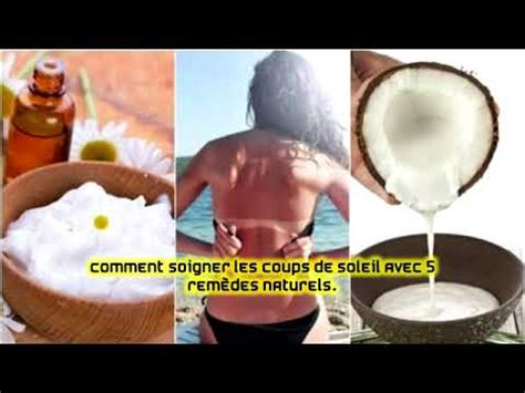 Comment Soigner Les Coups De Soleil Avec Rem Des Naturels Youtube