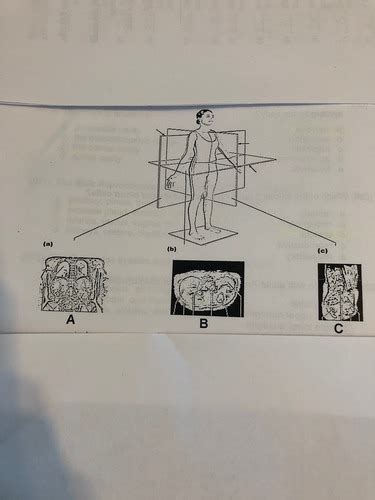 Anatomy Lab Exam 1 Flashcards Quizlet