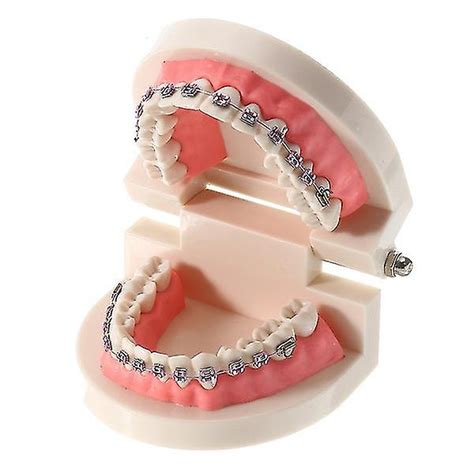 Dental Orthodontic Teeth Model With Ortho Metal Ceramic Bracket Arch