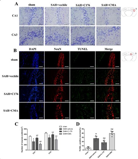 Effect Of Sting On Hippocampus Injury At Days After Sah A