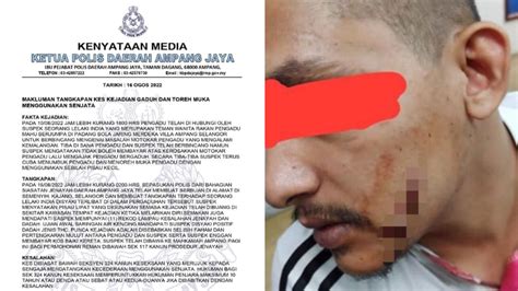 Polis Tahan Lelaki Disyaki Toreh Muka Rakan Dalam Pergaduhan TVS