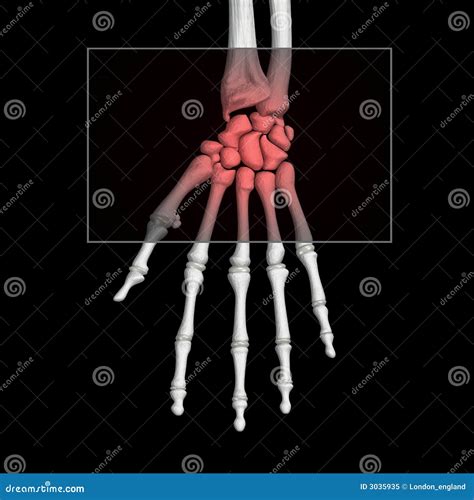 Sore Wrist stock illustration. Illustration of health - 3035935