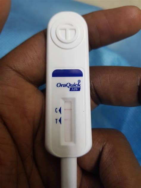 HOW A FALSE HIV-POSITIVE TEST CHANGED MY LIFE FOR HOURS, BY DR.MOKAYA