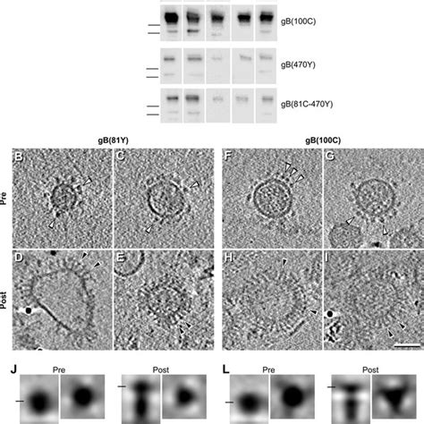 Characterization Of Pseudotyped HIV Particles And Microvesicles