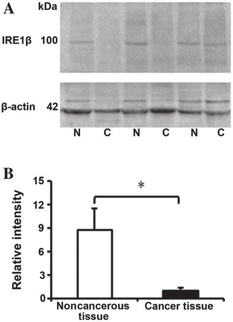 Western Blot Analysis Of Ire A The Representative Immunob Lotting