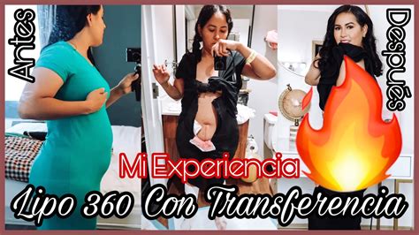 Lipo 360 “bbl”🍑 Mi Experiencia Donde Y Con Quien Me OperÉ Resultados Con 4 Semanas🔥 Youtube