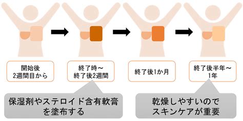 乳がん｜広島大学大学院医系学研究科 放射線腫瘍学 広島大学病院 放射線治療科