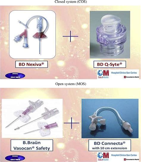 Indwell Times Complications And Costs Of Open Vs Closed Safety