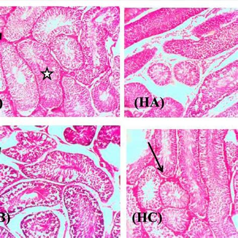 Photomicrographs Of The Testis Of Male Wistar Rats Exposed To Different