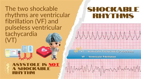 What Is Shockable Rhythm Flash Sales Jkuatacke