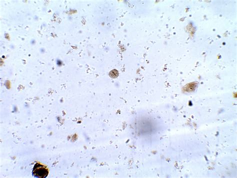 Entamoeba Coli Cyst Parasitology