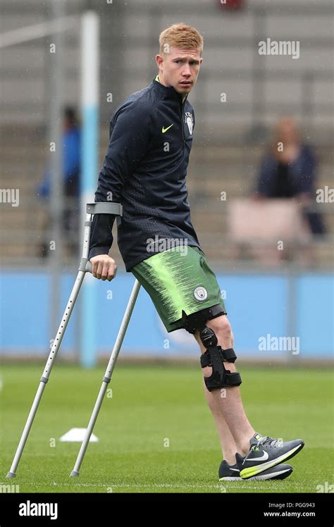 Manchester Citys Kevin De Bruyne On Crutches Hi Res Stock Photography