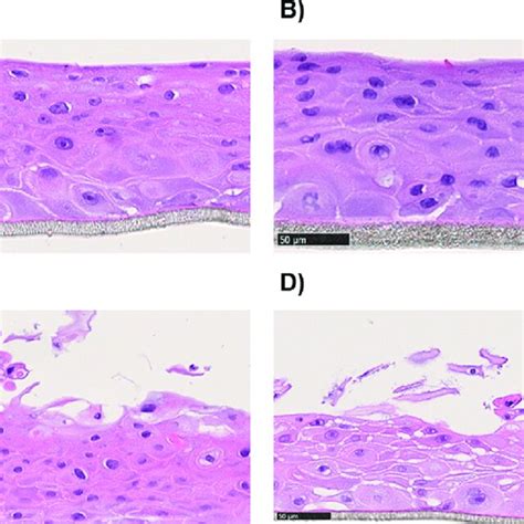 Histology Of The D Oral Mucosal Human Equivalent Treated With Eb At