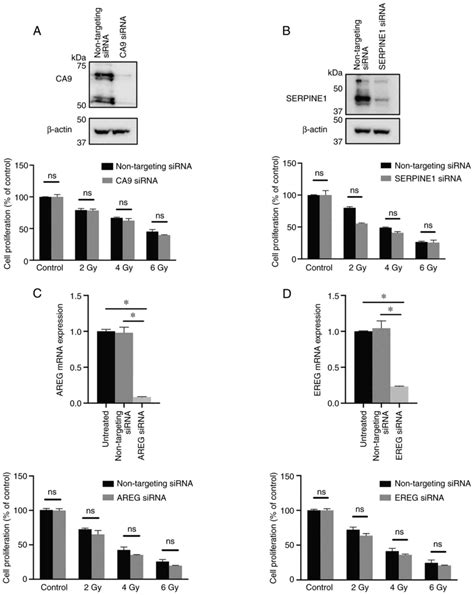 Hypoxia Induces Radioresistance Epithelial‑mesenchymal Transition