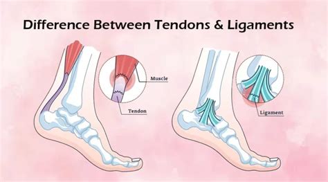 Tendons Vs Ligaments Common Injuries Archives Mobile Physiotherapy Clinic