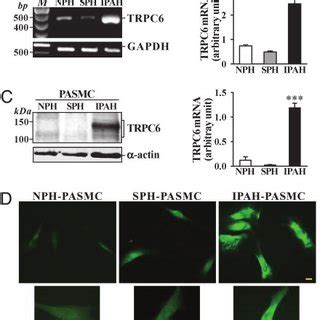 Trpc Mrna And Protein Expression Is Increased In Pulmonary Tissues