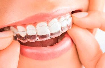 Invisalign El Paso Tx Dentist Near Me