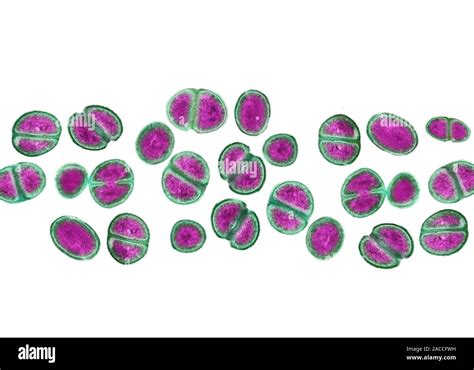 Mrsa Bacteria Coloured Transmission Electron Micrograph Tem Of